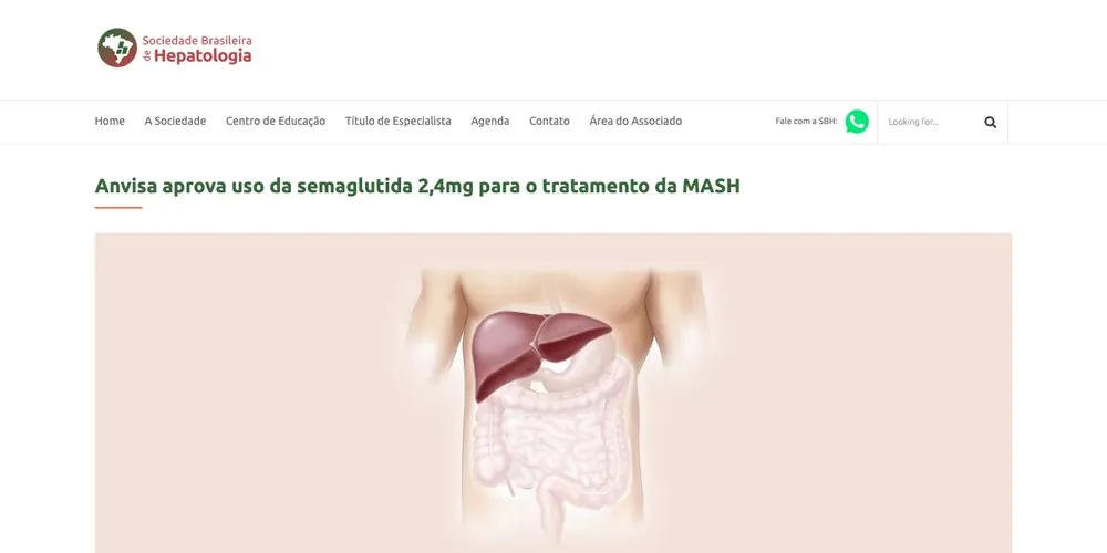 Manchete da Sociedade Brasileira de Hepatologia sobre a aprovação da semaglutida 2,4 mg para MASH